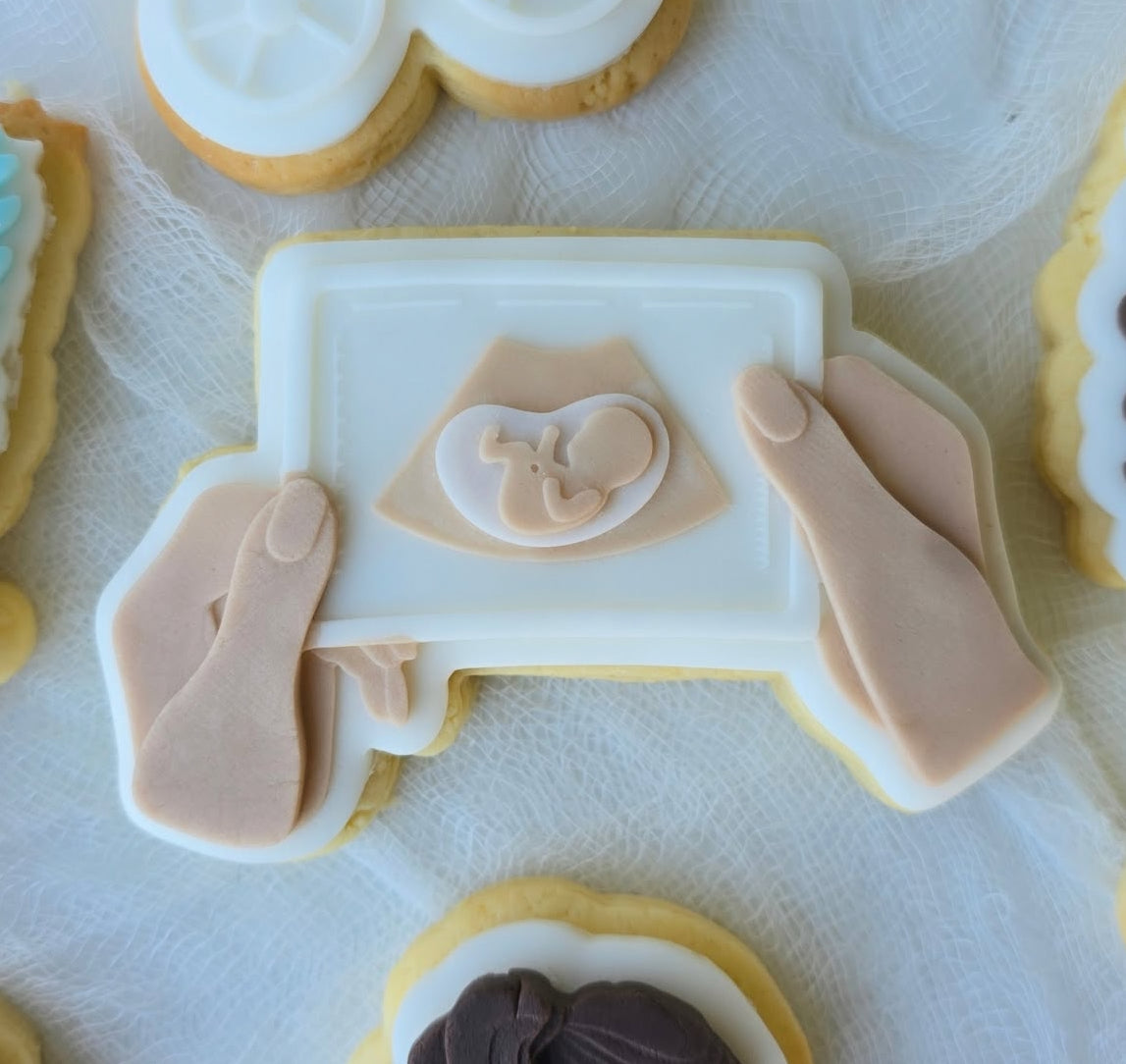 Baby Scan Photo
